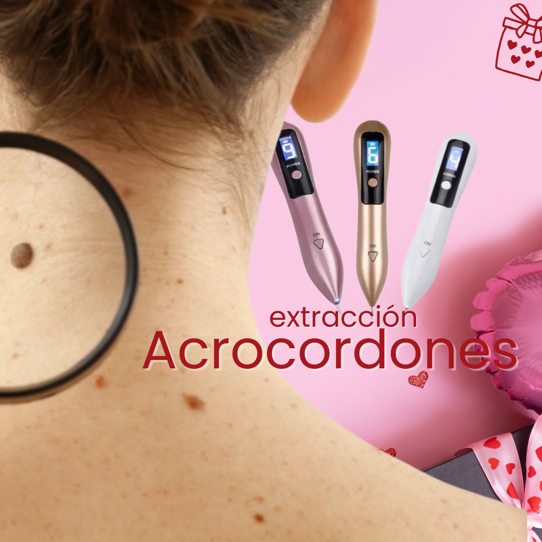 Extracción de Acrocordones